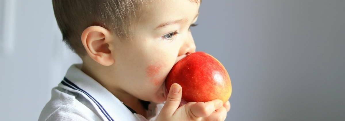 Allergia alimentare nei bambini